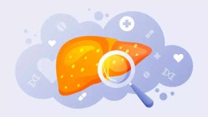 Accurate Blood Test Can Detect Liver Damage Years Before Symptoms Appear, Study Finds