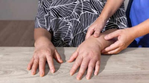 Finger Swelling: 8 Common Causes, From Arthritis to Fluid Retention, and How to Manage Them