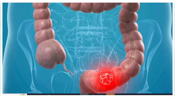 Person holding stomach in pain