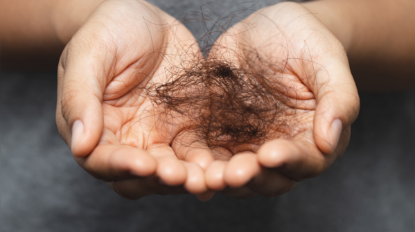 Sudden hair fall
