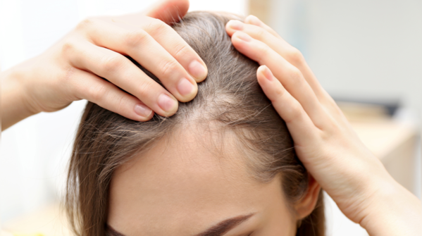Thinning of hair